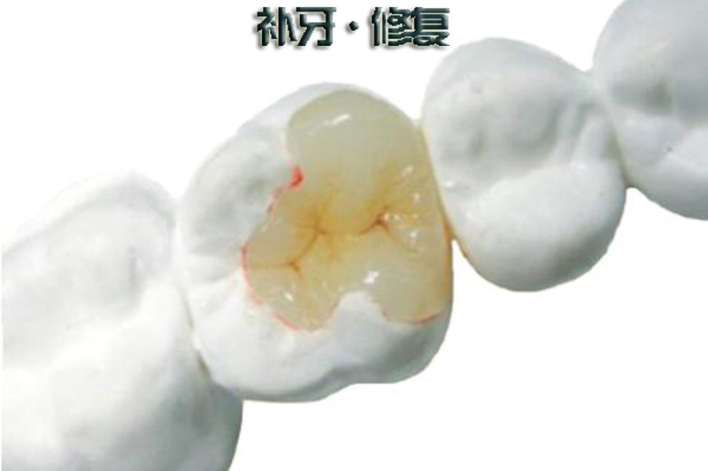 抚州拔牙:守护牙齿健康的必经之路